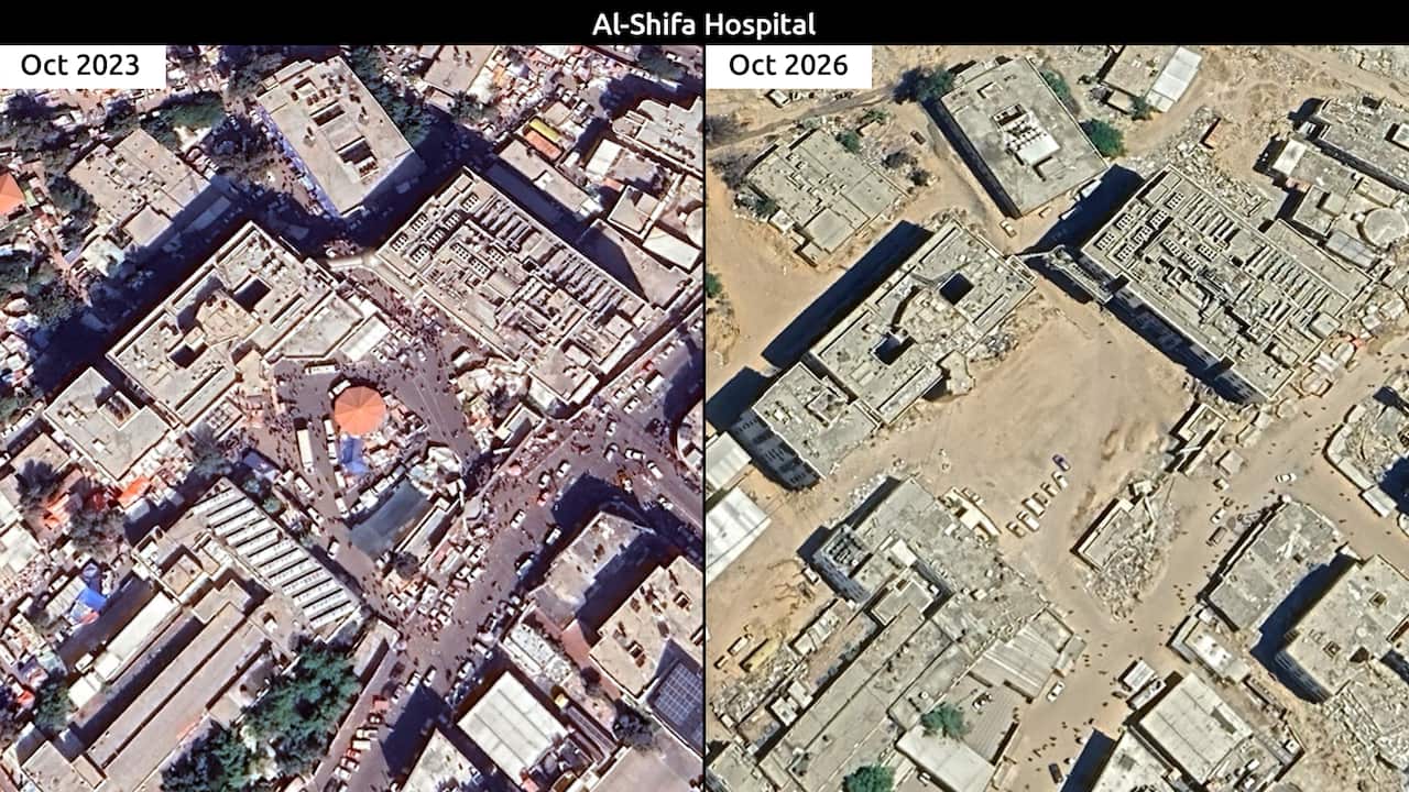 Gaza, al-Shifa hospital complex damaged facade 2026